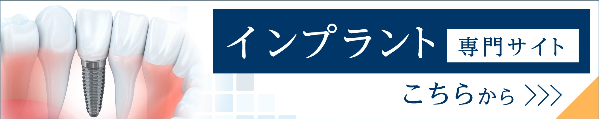 インプラント専門サイト こちらから