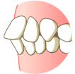 歯並びや噛み合わせが気になる