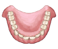 総入れ歯