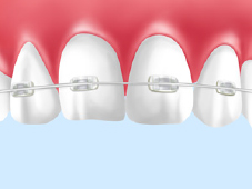 矯正歯科とは