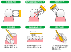 STEP.2ブラッシング指導