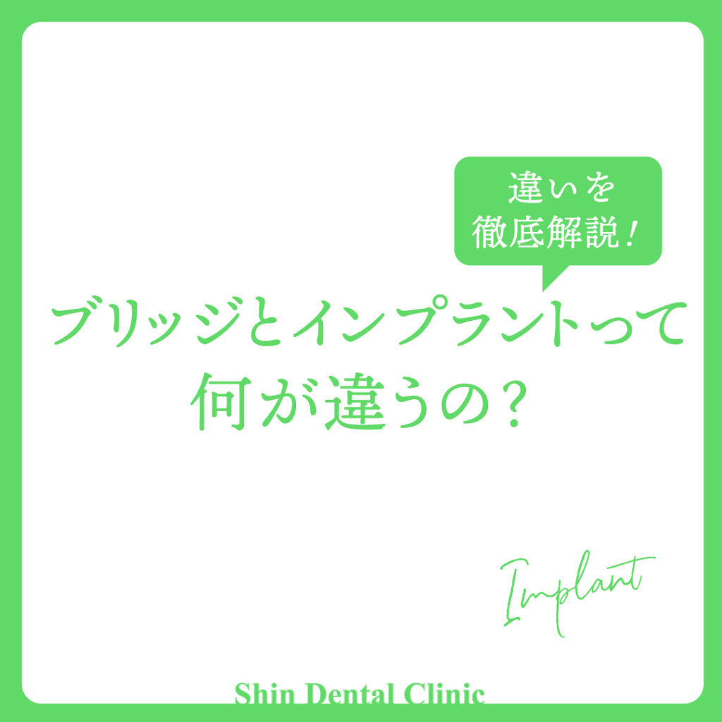 ブリッジとインプラントって何が違うの？