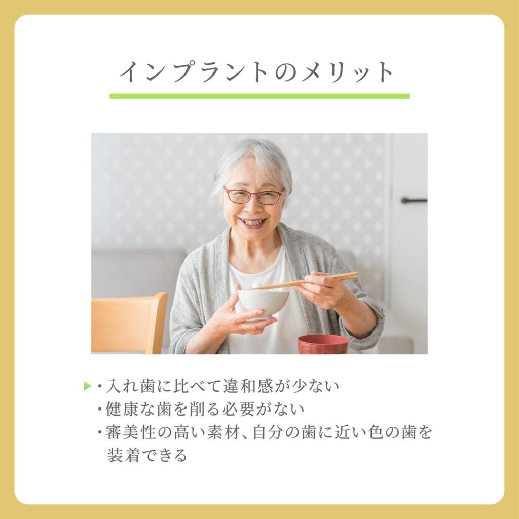 インプラントのメリット