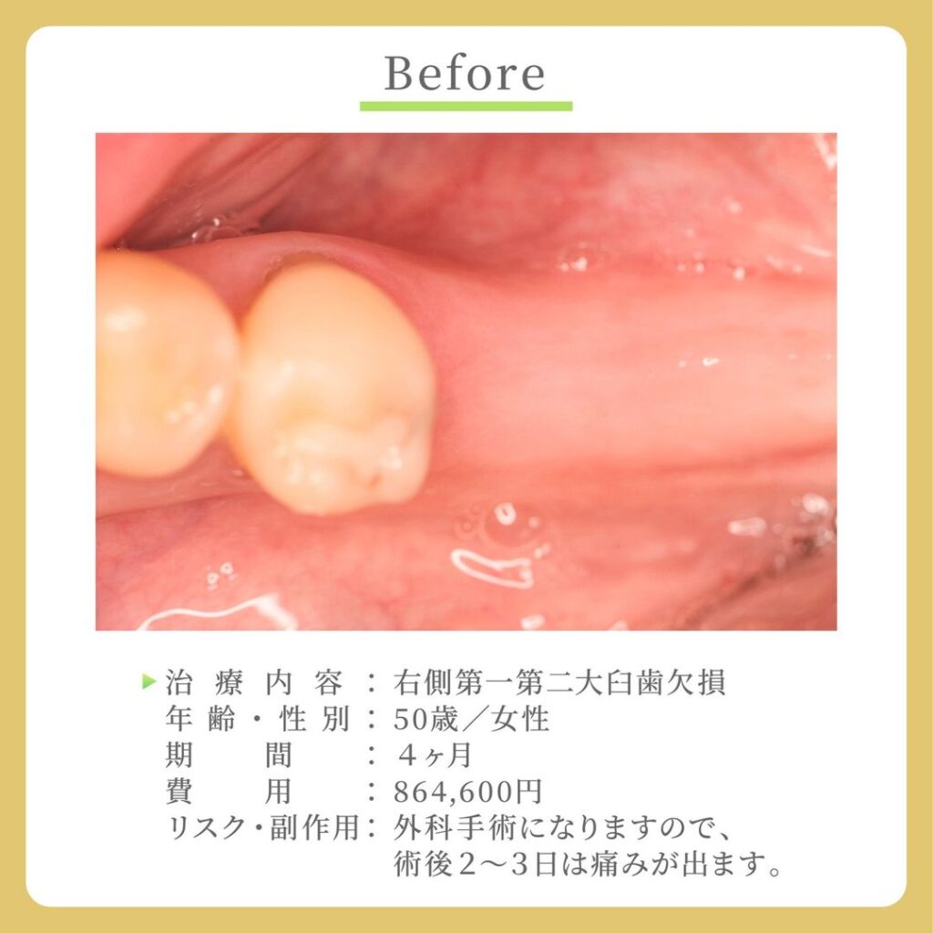 歯