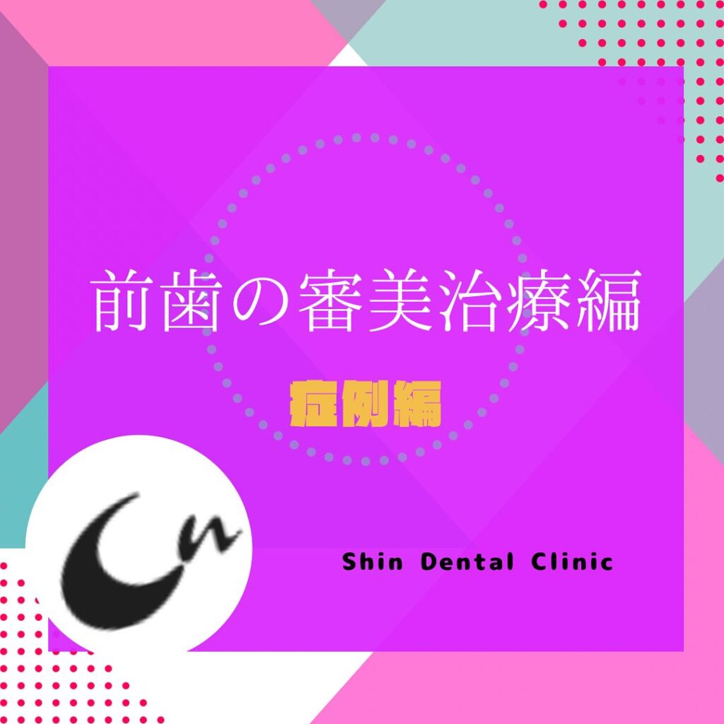 前歯の審美治療