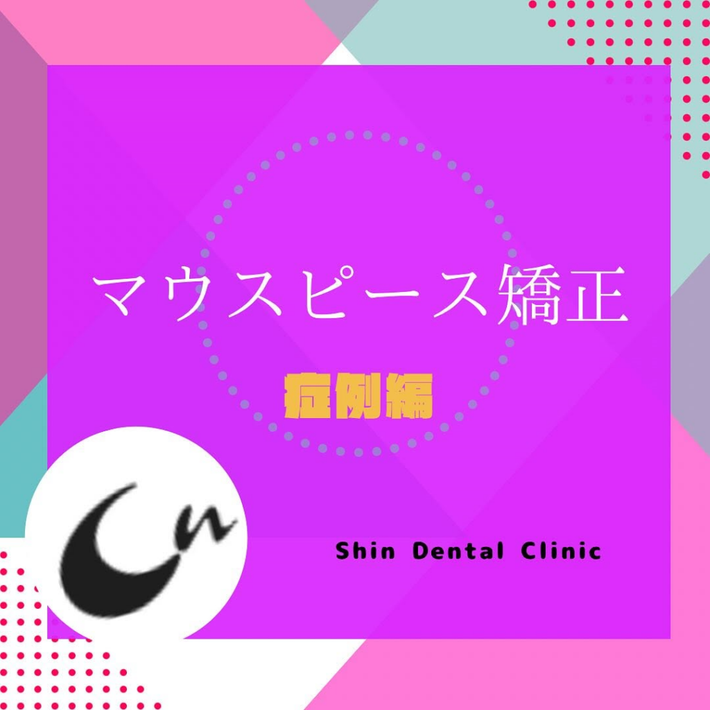 マウスピース矯正