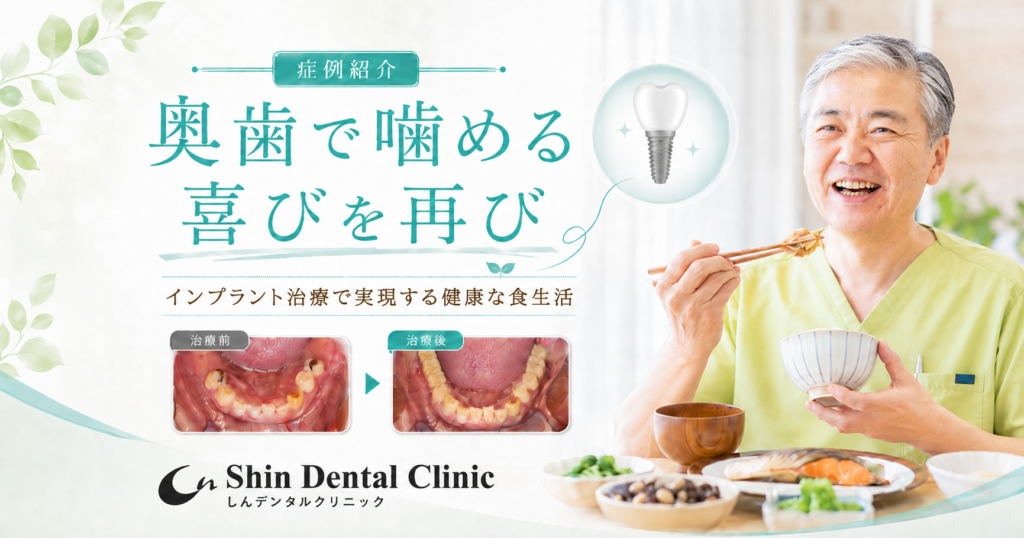 奥歯で噛める喜びを再び✨インプラント治療で実現する健康な食生活🦷