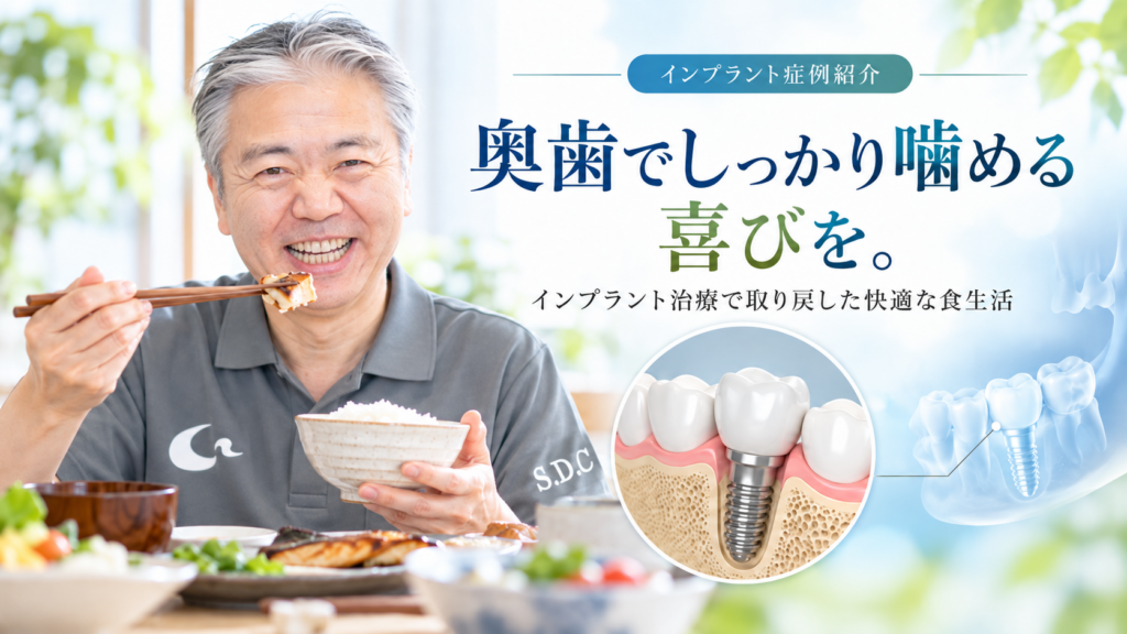 【症例紹介】「奥歯でしっかり噛める」喜びを。インプラント治療で取り戻した快適な食生活